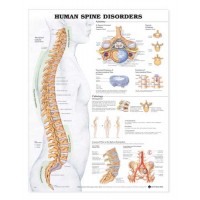 Human Spine Disorders Anatomical Chart  20  x 26
